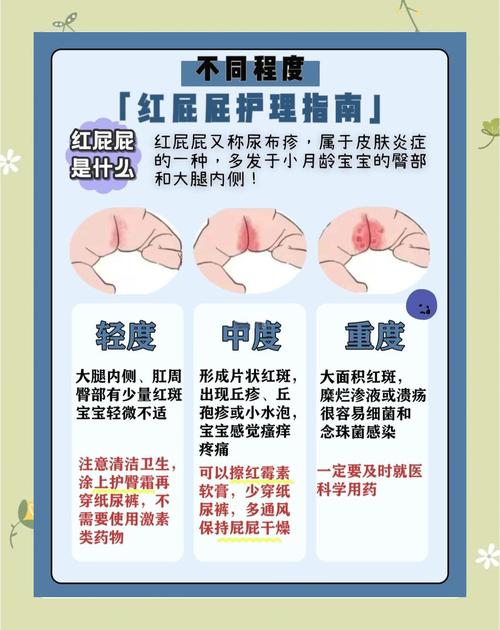 新生儿红屁股到底擦什么好?这些方法真的安全有效吗?-第2张图片-郑州医学网 新生儿红屁股到底擦什么好?这些方法真的安全有效吗?-第2张图片-郑州医学网