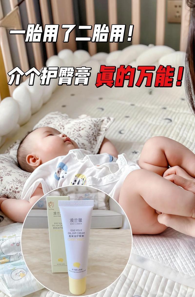 新生儿红屁股到底擦什么好?这些方法真的安全有效吗?-第1张图片-郑州医学网 新生儿红屁股到底擦什么好?这些方法真的安全有效吗?-第1张图片-郑州医学网