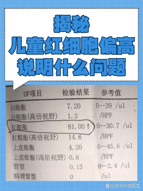 新生儿红细胞偏高是否严重?需要关注哪些潜在风险?-第1张图片-郑州医学网 新生儿红细胞偏高是否严重?需要关注哪些潜在风险?-第1张图片-郑州医学网