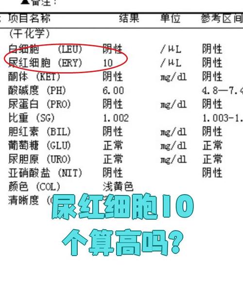 新生儿红细胞偏高是否严重?需要关注哪些潜在风险?-第3张图片-郑州医学网 新生儿红细胞偏高是否严重?需要关注哪些潜在风险?-第3张图片-郑州医学网