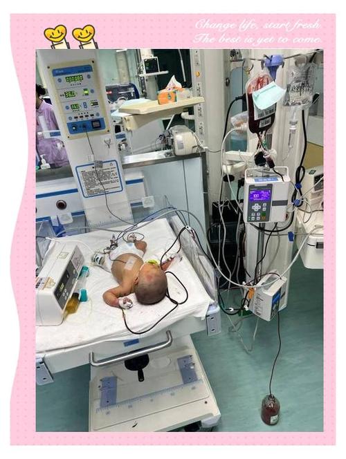 新生儿黄疸换血治疗的成功率究竟有多高?影响因素和风险又该如何把控?-第3张图片-郑州医学网 新生儿黄疸换血治疗的成功率究竟有多高?影响因素和风险又该如何把控?-第3张图片-郑州医学网