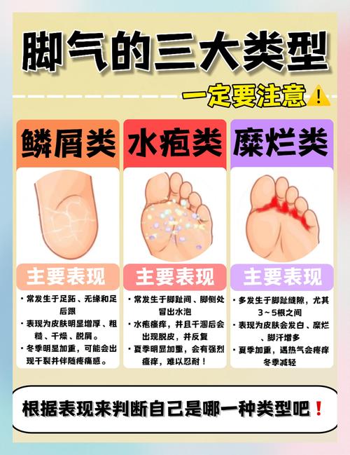 儿童脚脱皮是缺乏营养还是皮肤疾病？家长该如何正确应对？-第1张图片-郑州医学网