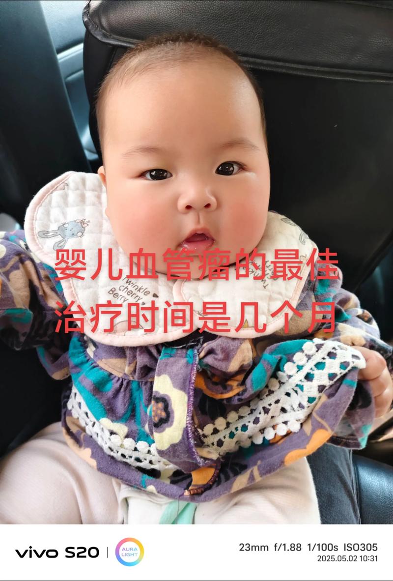 新生儿血管瘤生长速度过快怎么办?家长该如何应对与护理?-第2张图片-郑州医学网 新生儿血管瘤生长速度过快怎么办?家长该如何应对与护理?-第2张图片-郑州医学网