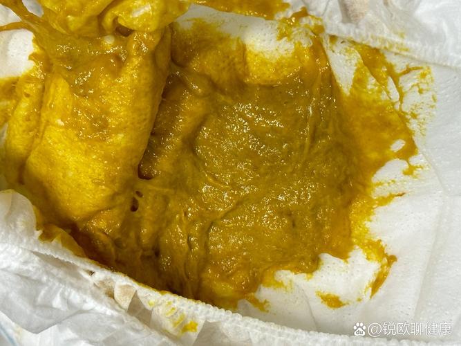 新生儿大便黏糊糊的,是消化不良还是正常现象?-第1张图片-郑州医学网 新生儿大便黏糊糊的,是消化不良还是正常现象?-第1张图片-郑州医学网