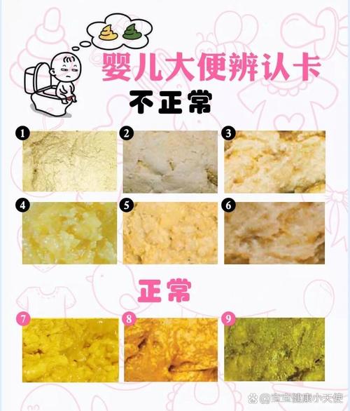新生儿拉大便臭正常吗-第1张图片-郑州医学网
