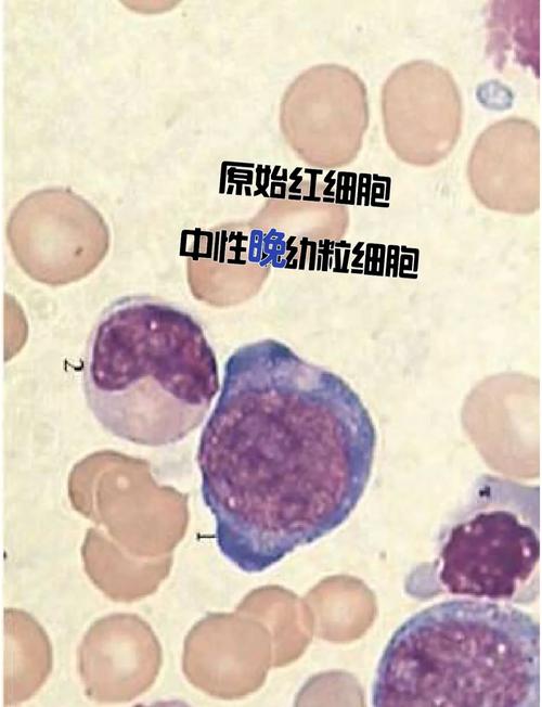 新生儿白细胞红细胞低到底是怎么回事?需要紧急处理吗?-第3张图片-郑州医学网 新生儿白细胞红细胞低到底是怎么回事?需要紧急处理吗?-第3张图片-郑州医学网