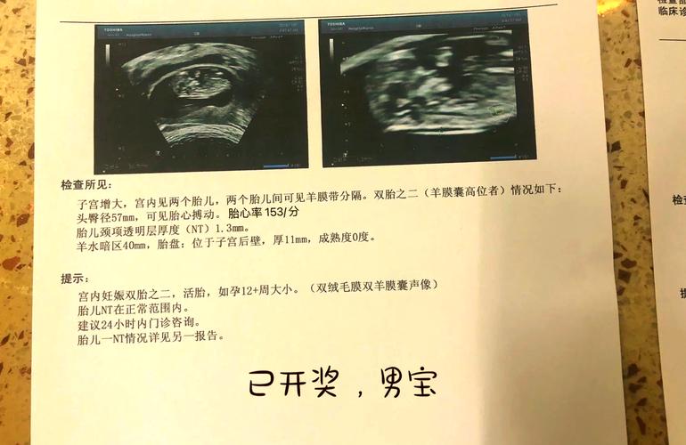 怀孕期间做春梦真的能预示生男孩吗？科学依据在哪里？-第3张图片-郑州医学网