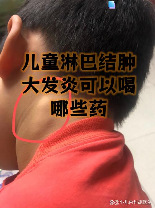 儿童肚子疼伴淋巴结发炎，是感染还是其他原因在作祟？-第3张图片-郑州医学网