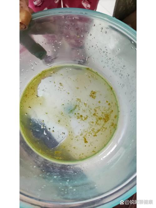 新生儿大便突然喷黄水带屎，是消化不良还是感染了？-第3张图片-郑州医学网