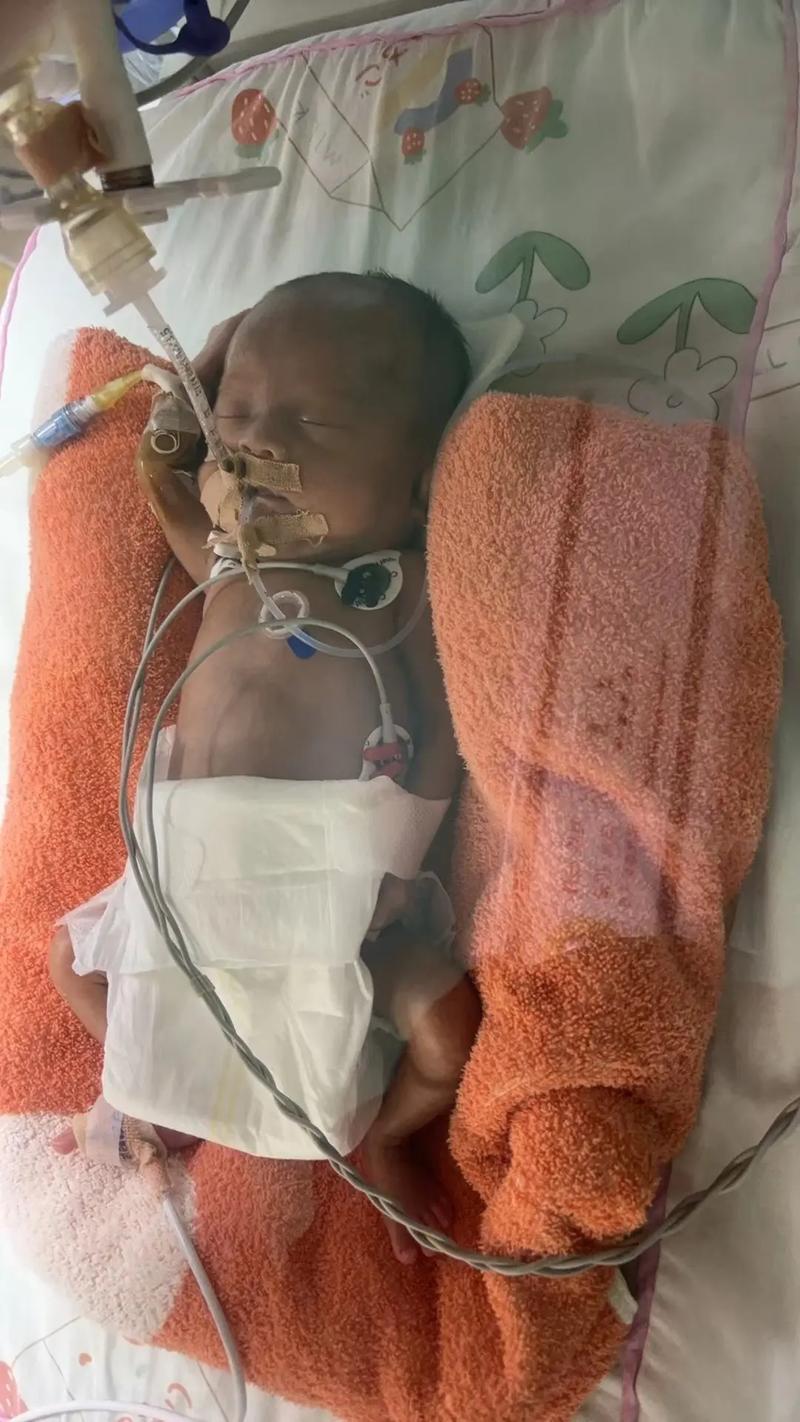 新生儿胆管细窄有哪些典型表现？家长该如何早期识别与应对？-第2张图片-郑州医学网