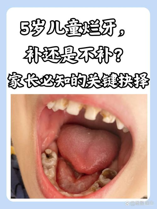 儿童牙齿不整齐会影响颜值和健康？家长该如何科学干预？-第3张图片-郑州医学网