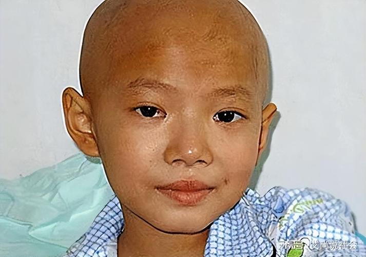 儿童白血病早期症状有哪些容易被家长忽略的信号？-第2张图片-郑州医学网