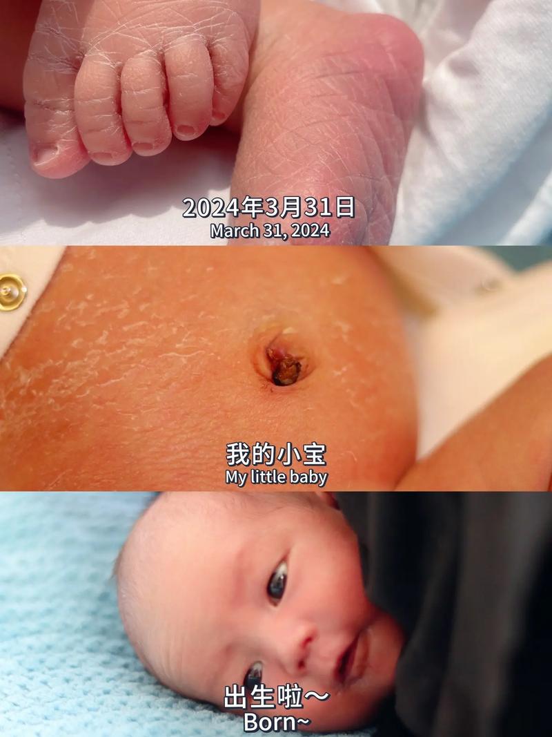 新生儿粪便吸入综合症究竟会对宝宝造成哪些不可逆的伤害？-第3张图片-郑州医学网