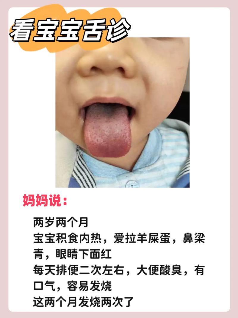 新生儿舌头抖是正常生理现象还是疾病信号？需关注哪些伴随症状？-第3张图片-郑州医学网