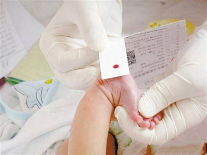 新生儿足跟血阳性结果普遍吗？家长该如何正确看待与应对？-第1张图片-郑州医学网