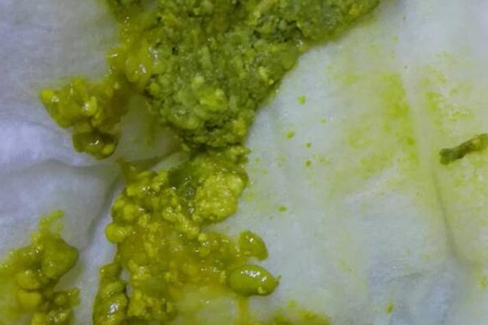 新生儿吃益生菌后拉绿便,是正常反应还是需要停用益生菌?-第1张图片-郑州医学网 新生儿吃益生菌后拉绿便,是正常反应还是需要停用益生菌?-第1张图片-郑州医学网