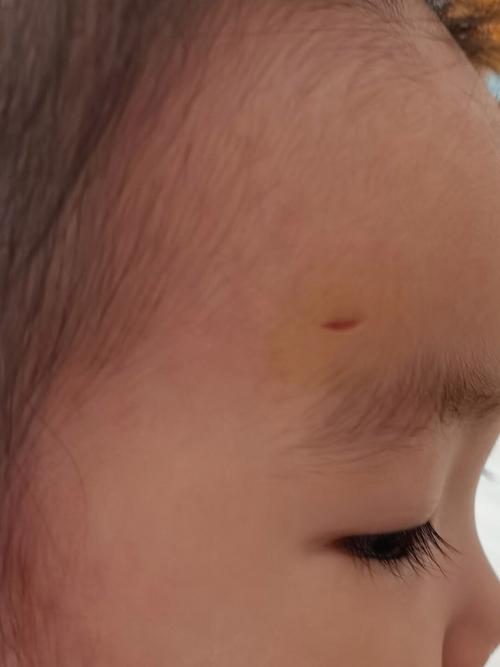 不小心碰到新生儿头部后,家长该如何判断和处理才安全?-第1张图片-郑州医学网 不小心碰到新生儿头部后,家长该如何判断和处理才安全?-第1张图片-郑州医学网