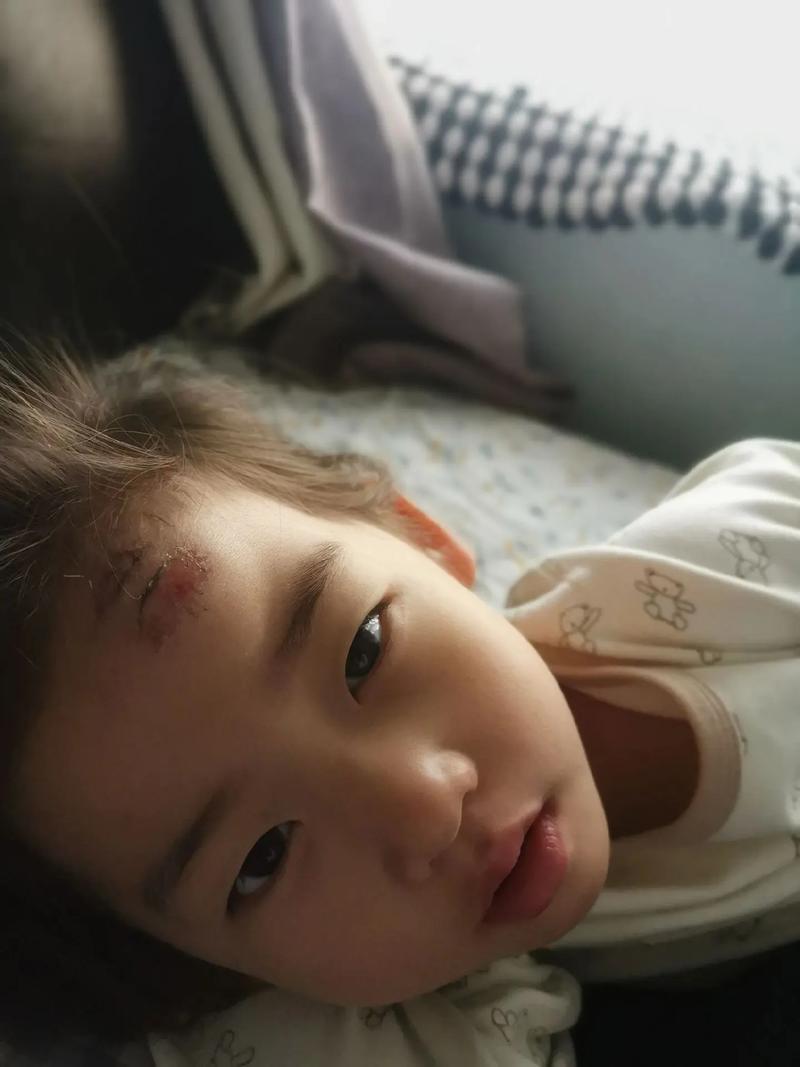 不小心碰到新生儿头部后,家长该如何判断和处理才安全?-第2张图片-郑州医学网 不小心碰到新生儿头部后,家长该如何判断和处理才安全?-第2张图片-郑州医学网