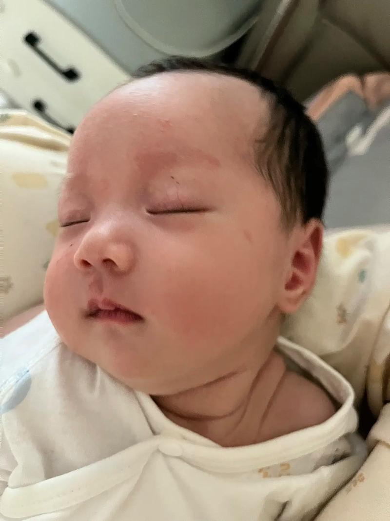 新生儿脖子肉多双下巴是正常现象吗?需要干预吗?-第1张图片-郑州医学网 新生儿脖子肉多双下巴是正常现象吗?需要干预吗?-第1张图片-郑州医学网