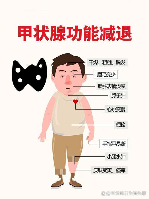 孕期甲状腺功能减退症对母婴健康有哪些潜在影响?-第2张图片-郑州医学网 孕期甲状腺功能减退症对母婴健康有哪些潜在影响?-第2张图片-郑州医学网