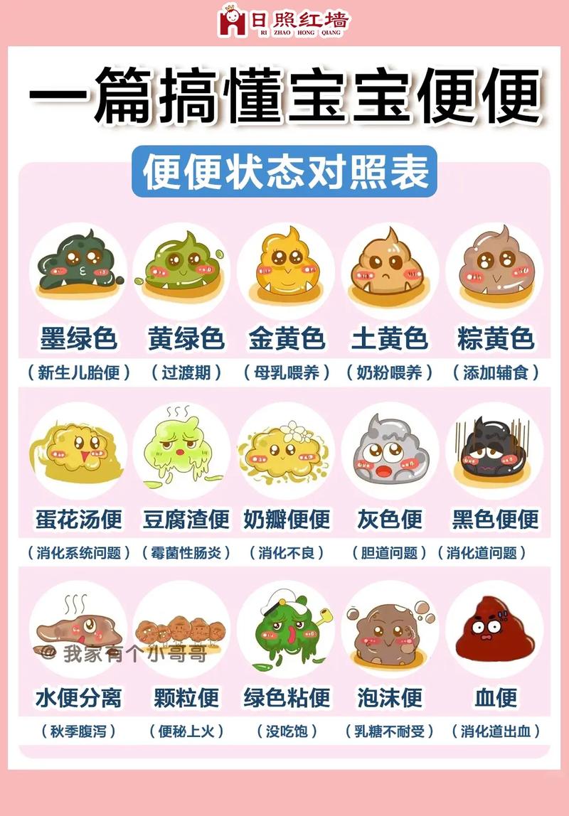 新生儿拉屎正常标准是什么？颜色、频率、性状怎样才算健康？-第3张图片-郑州医学网