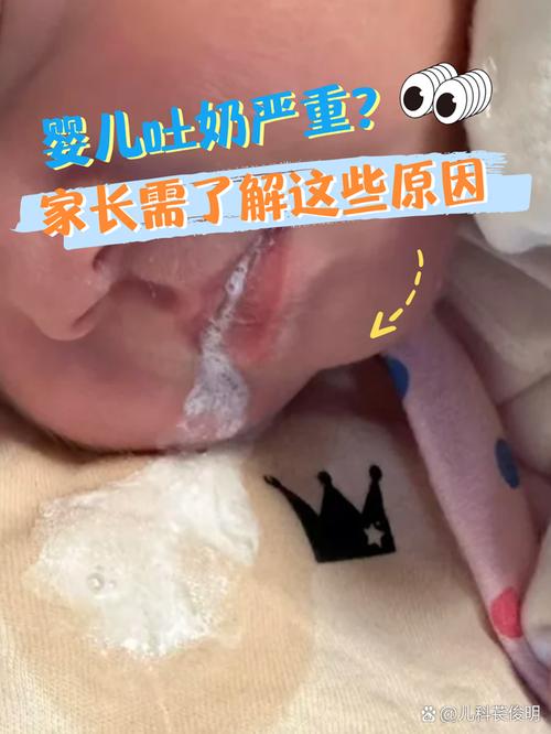 新生儿吐奶喷射状是正常现象吗?附图片解析原因与应对方法-第1张图片-郑州医学网 新生儿吐奶喷射状是正常现象吗?附图片解析原因与应对方法-第1张图片-郑州医学网