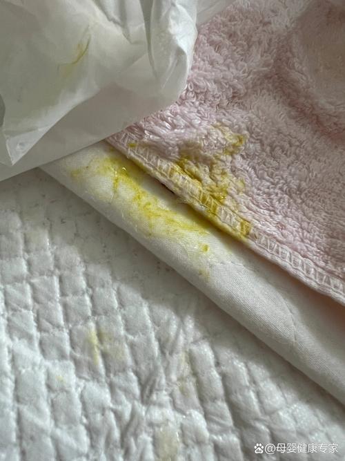 新生儿吐奶喷射状是正常现象吗?附图片解析原因与应对方法-第2张图片-郑州医学网 新生儿吐奶喷射状是正常现象吗?附图片解析原因与应对方法-第2张图片-郑州医学网