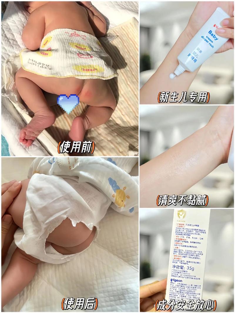 新生儿洗屁股到底该用湿巾还是温水？棉柔巾和护臀膏怎么选才不伤皮肤？-第2张图片-郑州医学网