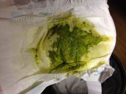 新生儿吐绿色是消化不良还是疾病信号？需警惕哪些异常情况？-第2张图片-郑州医学网