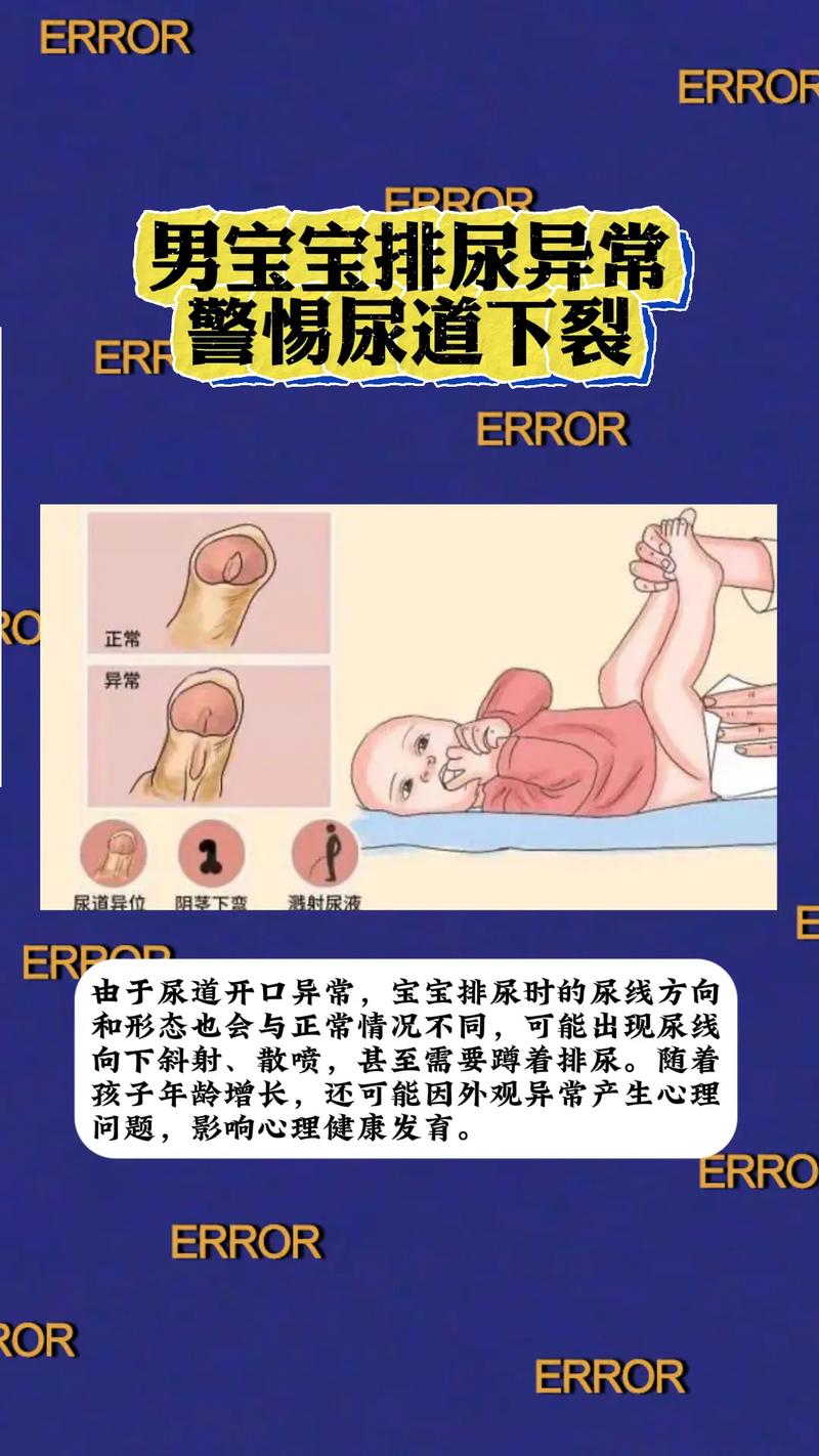 新生儿膀胱大究竟是怎么回事？是生理性发育还是病理性异常？-第3张图片-郑州医学网