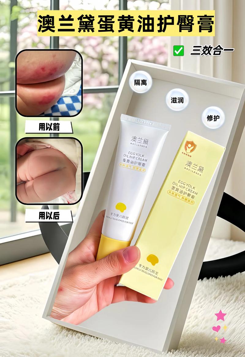 新生儿膀胱大究竟是怎么回事?是生理性发育还是病理性异常?-第2张图片-郑州医学网 新生儿膀胱大究竟是怎么回事?是生理性发育还是病理性异常?-第2张图片-郑州医学网