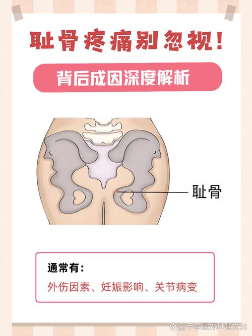 孕期耻骨疼是正常生理反应还是疾病信号？原因有哪些，如何缓解？-第2张图片-郑州医学网