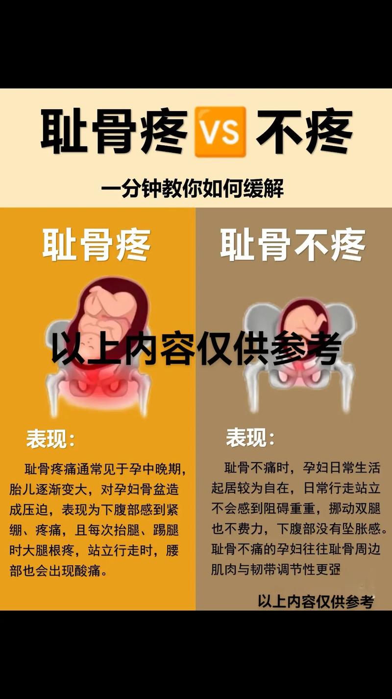 孕期耻骨疼是正常生理反应还是疾病信号？原因有哪些，如何缓解？-第3张图片-郑州医学网