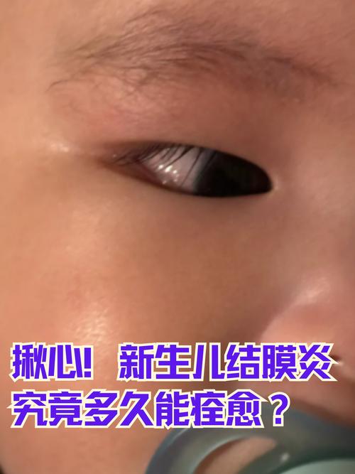 羊膜炎究竟会给新生儿带来哪些潜在的健康风险？-第2张图片-郑州医学网