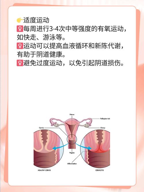 孕期同房后见红是危险信号吗？需立即就医还是先观察？-第3张图片-郑州医学网