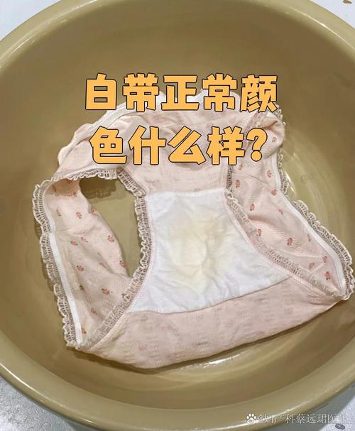 孕期白带有异味是正常现象吗?需要警惕哪些潜在问题?-第2张图片-郑州医学网 孕期白带有异味是正常现象吗?需要警惕哪些潜在问题?-第2张图片-郑州医学网