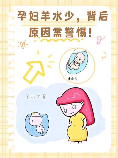 孕期羊水少究竟是什么原因导致的？对胎儿会有哪些影响？-第2张图片-郑州医学网