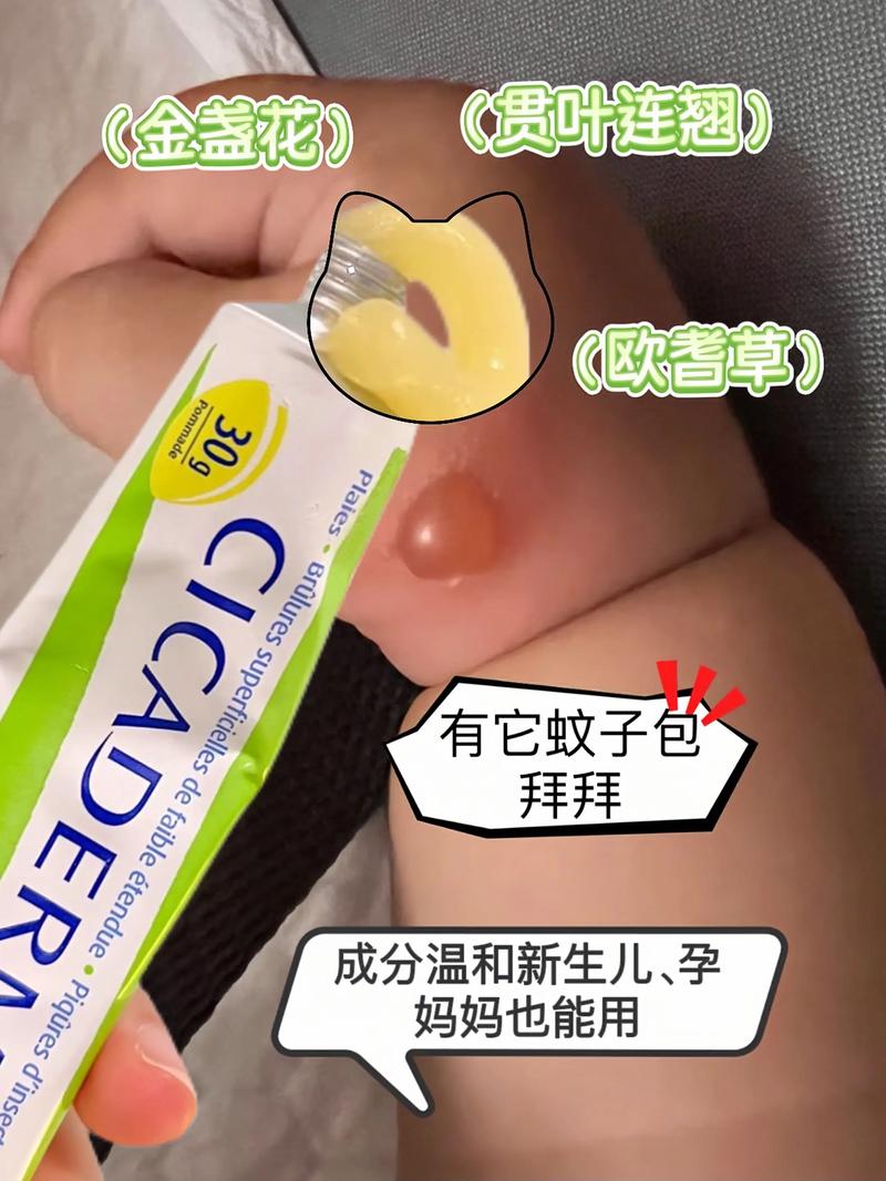 新生儿湿疹能用薄荷水治疗吗?这种偏方是否安全有效?-第1张图片-郑州医学网 新生儿湿疹能用薄荷水治疗吗?这种偏方是否安全有效?-第1张图片-郑州医学网