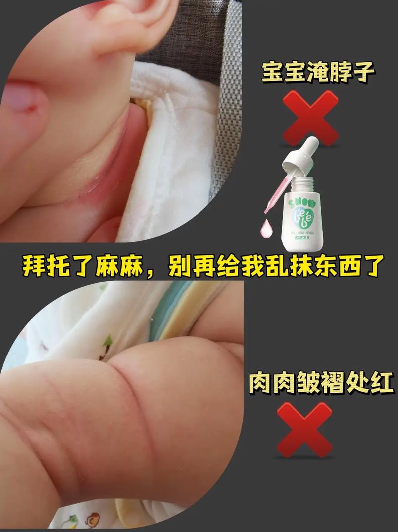 新生儿脖子短是正常现象吗？会影响发育吗？需要干预吗？-第3张图片-郑州医学网