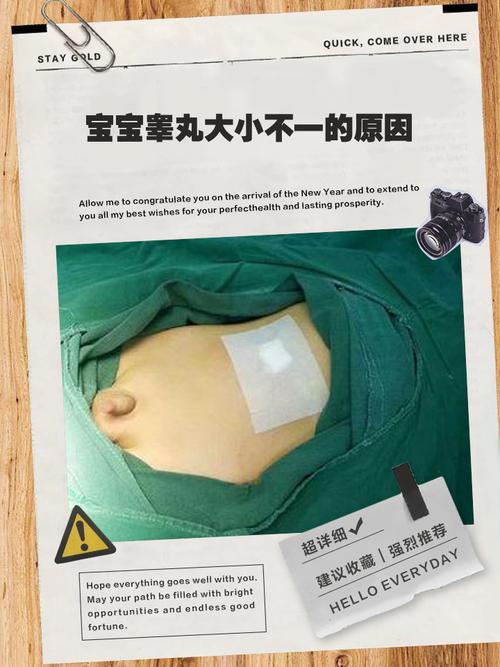 新生儿睾丸未下降，究竟是什么原因导致的呢？-第1张图片-郑州医学网