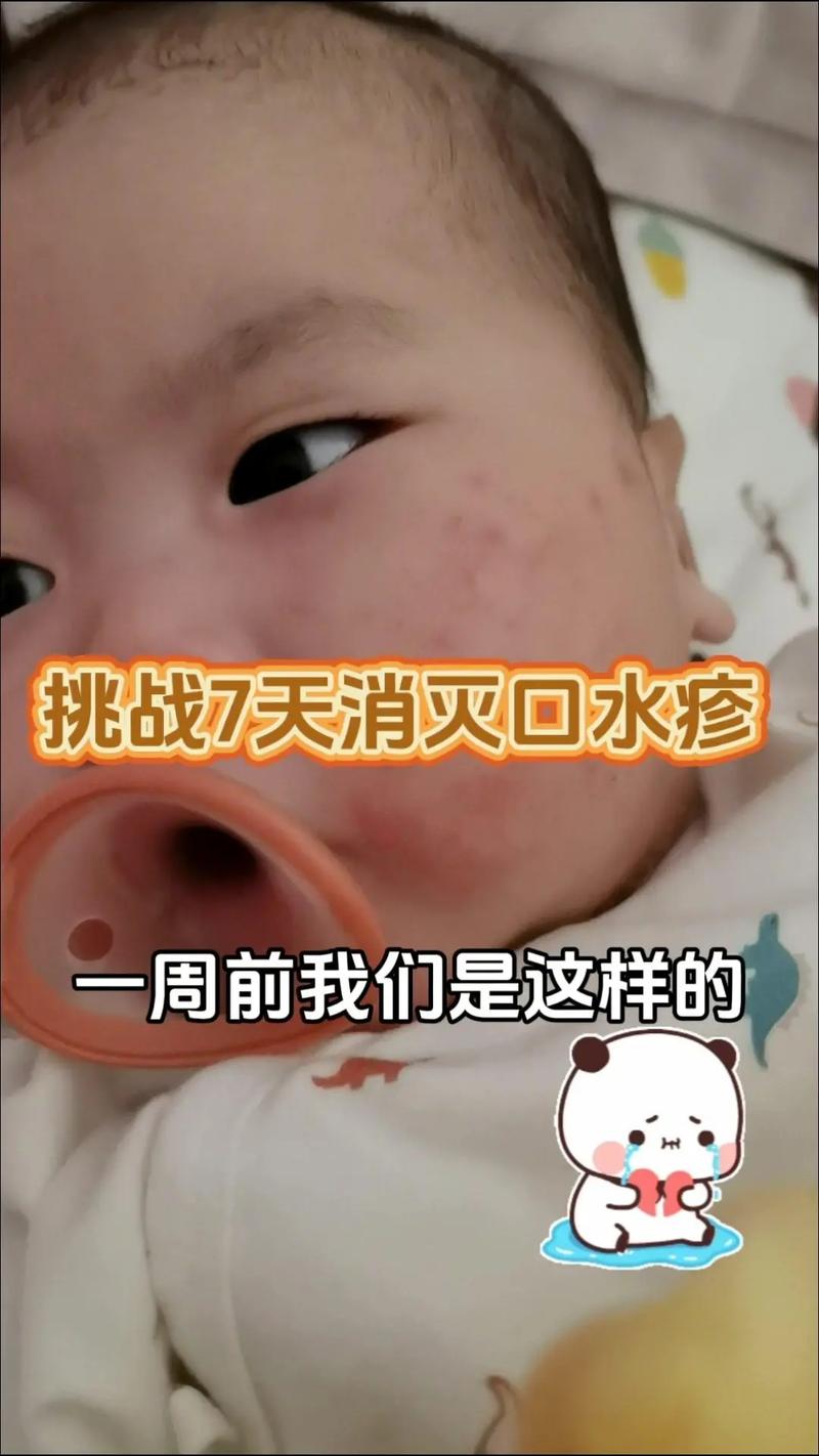 新生儿口水呛到后,家长如何正确处理才能避免风险?-第2张图片-郑州医学网 新生儿口水呛到后,家长如何正确处理才能避免风险?-第2张图片-郑州医学网