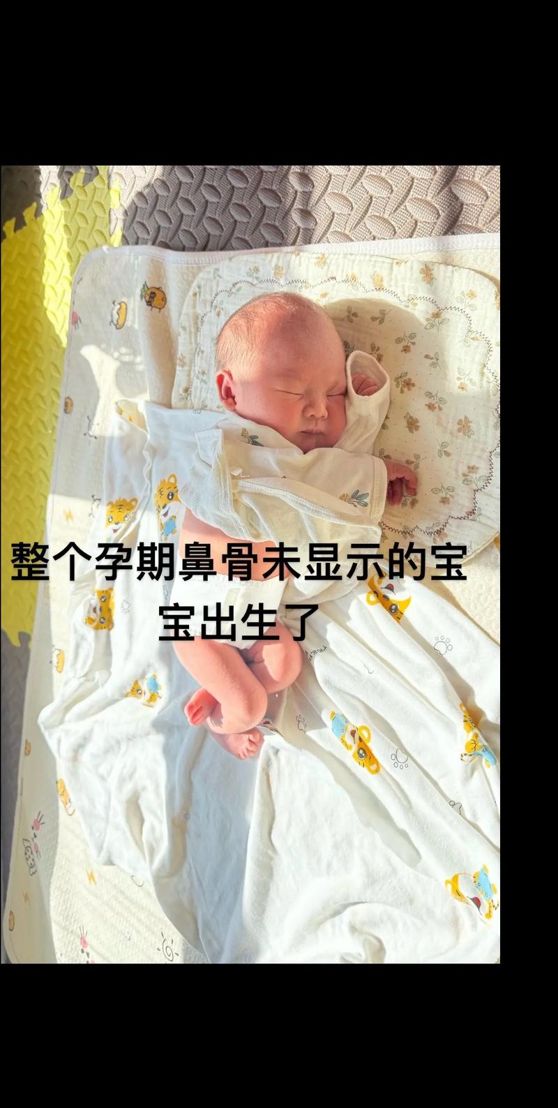 新生儿天生没有肛门，这种畸形真的能存活吗？-第3张图片-郑州医学网