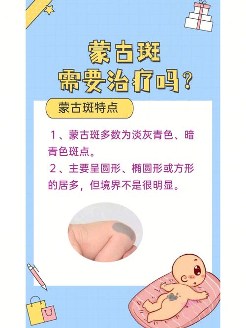 新生儿蒙古斑智商高吗-第1张图片-郑州医学网 新生儿蒙古斑智商高吗-第1张图片-郑州医学网