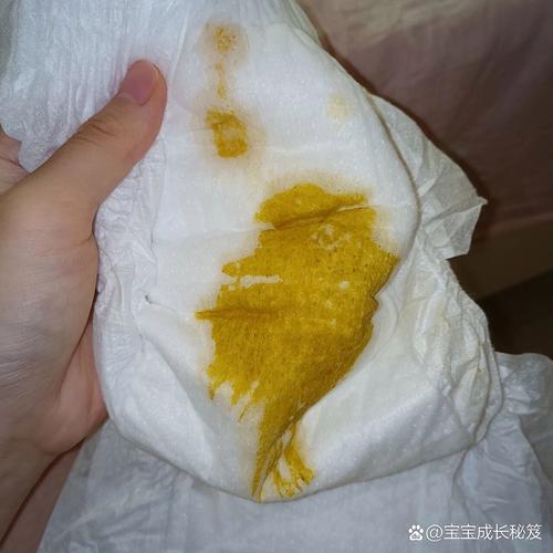 新生儿拉肚子且肚子咕咕响，是消化不良还是感染在作祟？-第1张图片-郑州医学网