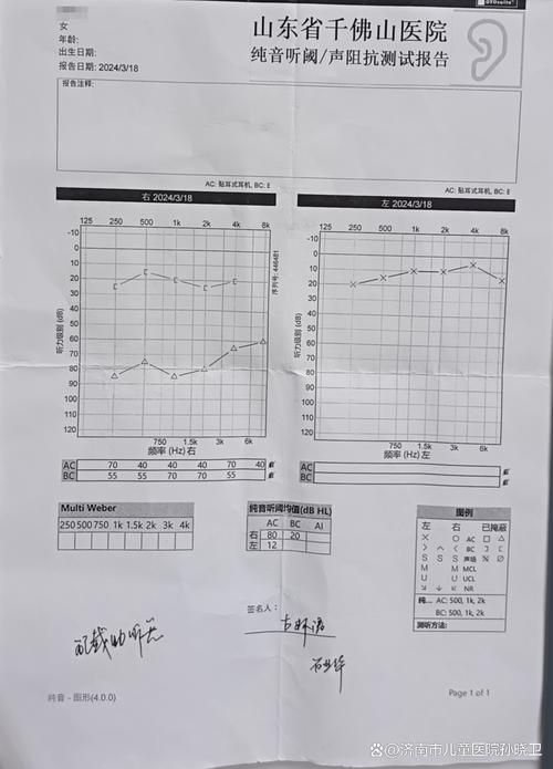 新生儿听力不通过概率-第1张图片-郑州医学网 新生儿听力不通过概率-第1张图片-郑州医学网