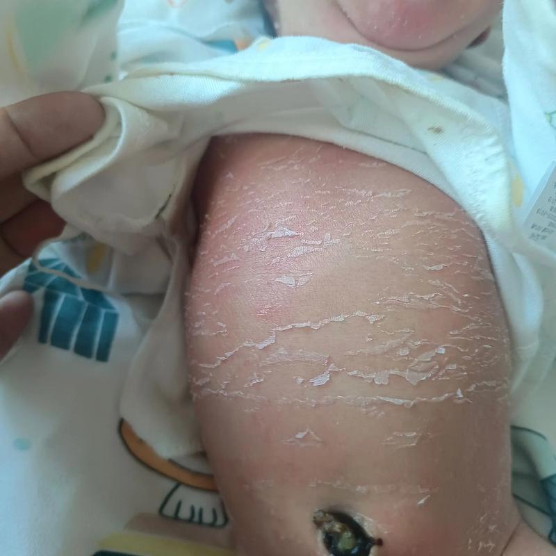 新生儿肚脐眼到底几天脱落?护理不当会影响愈合吗?-第2张图片-郑州医学网 新生儿肚脐眼到底几天脱落?护理不当会影响愈合吗?-第2张图片-郑州医学网