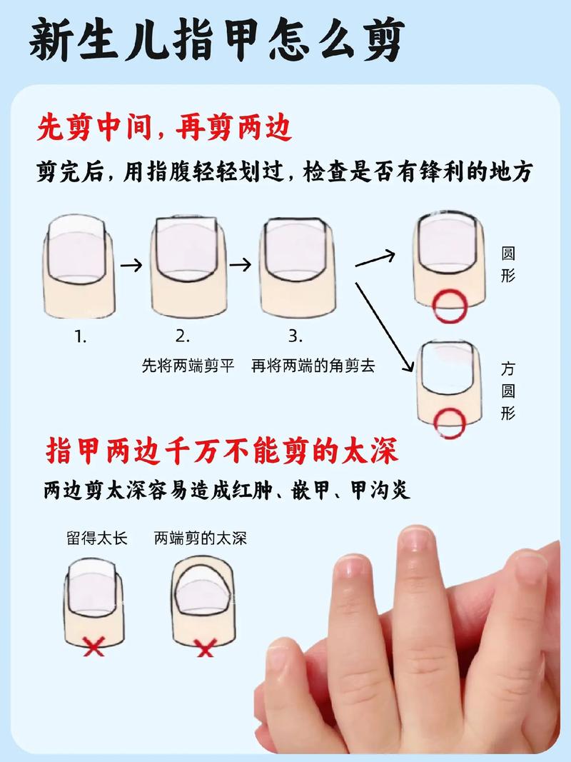 新生儿指甲剪出血了怎么办?紧急处理步骤和后续护理要注意什么?-第1张图片-郑州医学网 新生儿指甲剪出血了怎么办?紧急处理步骤和后续护理要注意什么?-第1张图片-郑州医学网