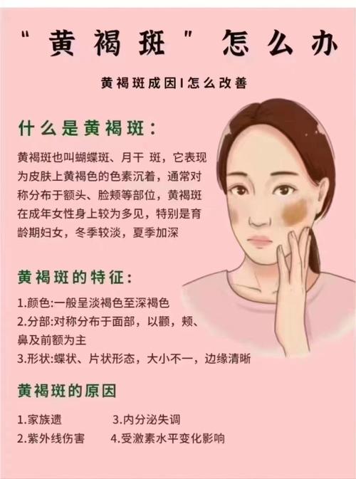 孕期如何有效预防脸上长斑?有哪些科学方法能避免孕期色斑形成?-第1张图片-郑州医学网 孕期如何有效预防脸上长斑?有哪些科学方法能避免孕期色斑形成?-第1张图片-郑州医学网