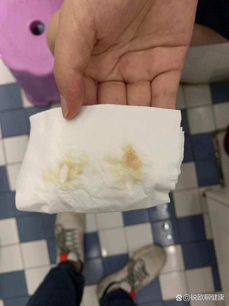 孕期下面流黄黄的东西，是正常分泌物还是感染信号？需要警惕哪些异常情况？-第1张图片-郑州医学网
