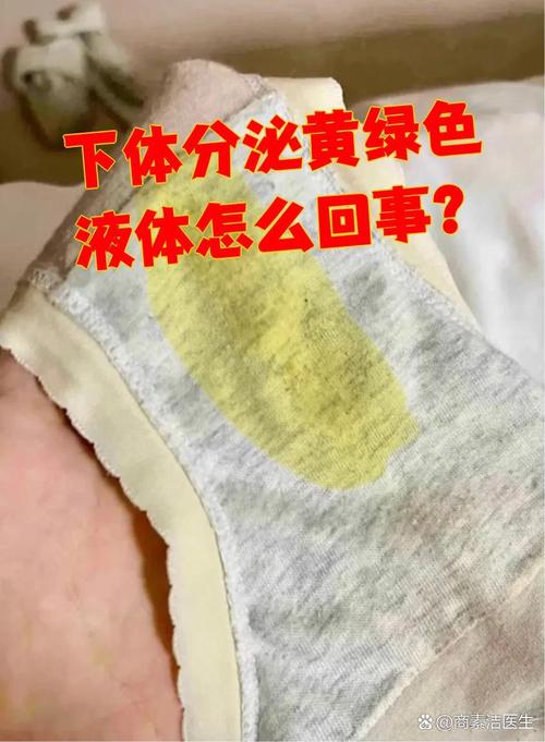 孕期下面流黄黄的东西，是正常分泌物还是感染信号？需要警惕哪些异常情况？-第3张图片-郑州医学网